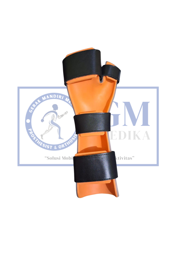 WRIST HAND ORTHOSIS