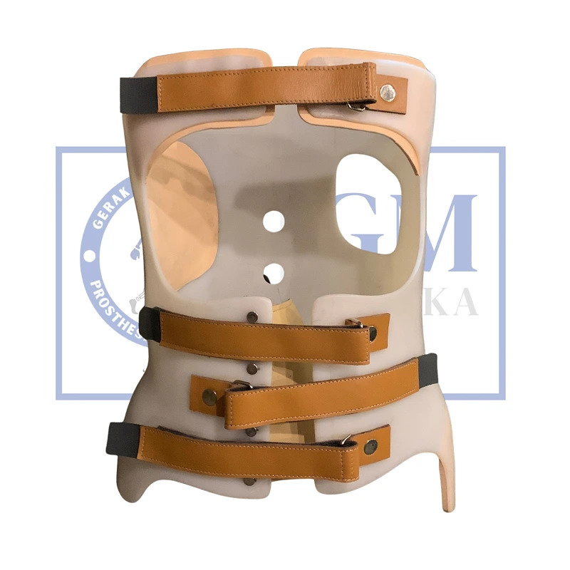 Jual scoliosis brace indonesia