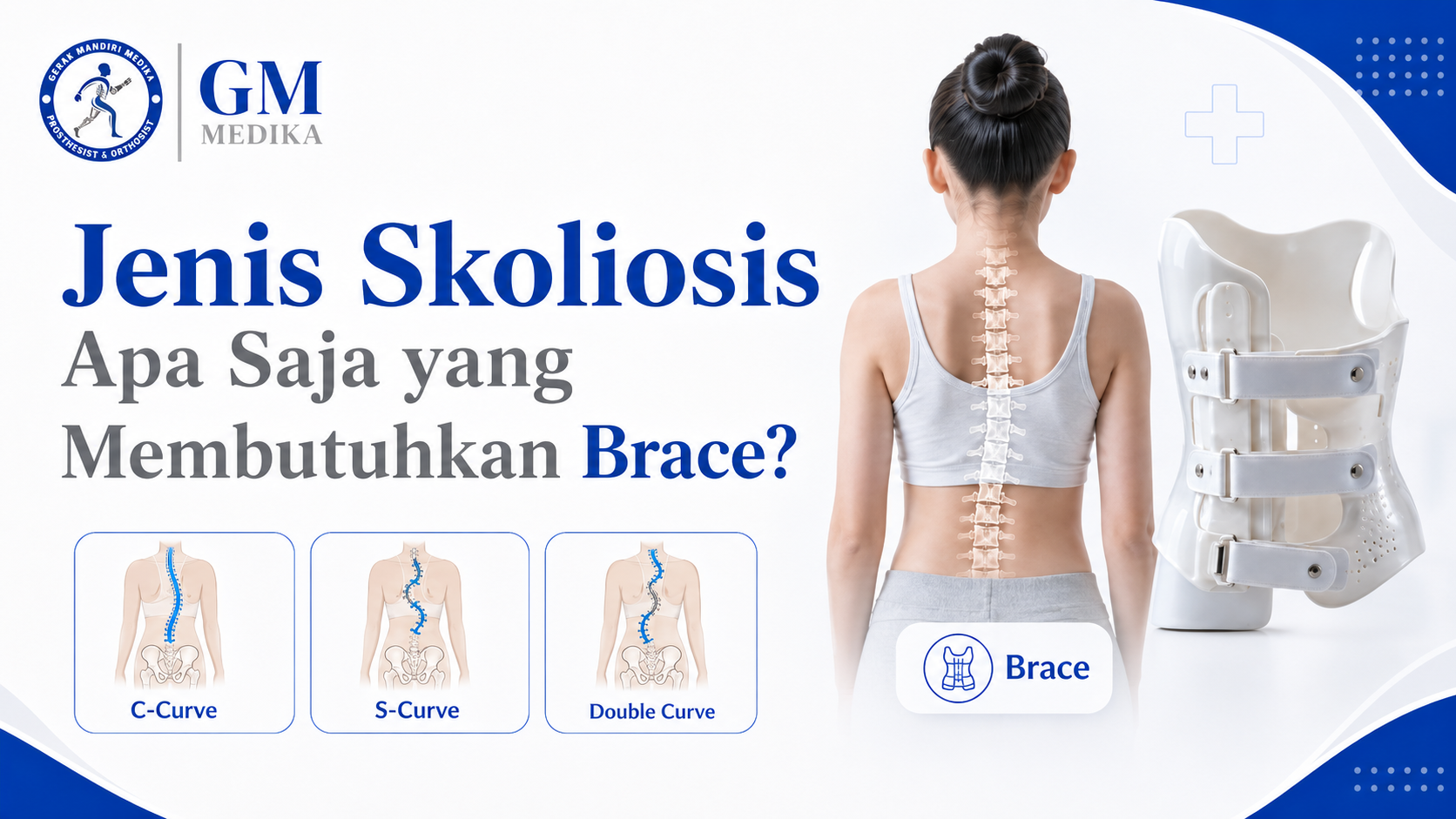 Jenis Skoliosis Apa Saja yang Membutuhkan Brace?