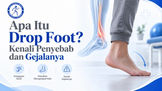 apa itu foot drop