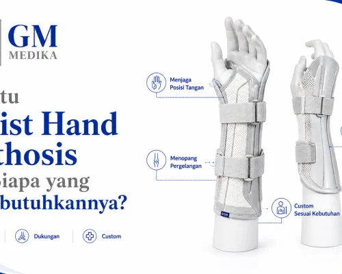 Apa Itu Wrist Hand Orthosis dan Siapa yang Membutuhkannya