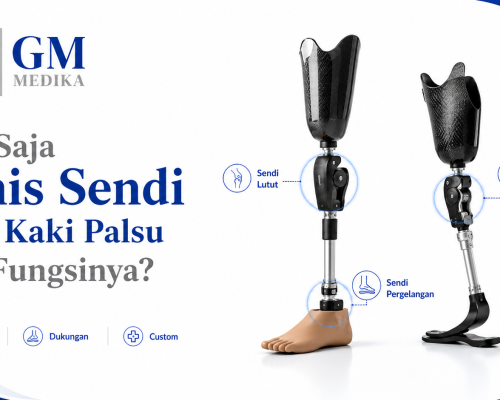 Apa Saja Jenis Sendi pada Kaki Palsu dan Fungsinya?