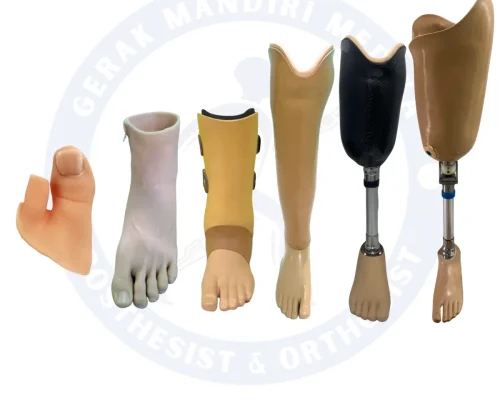 Jual Kaki Palsu Indonesia