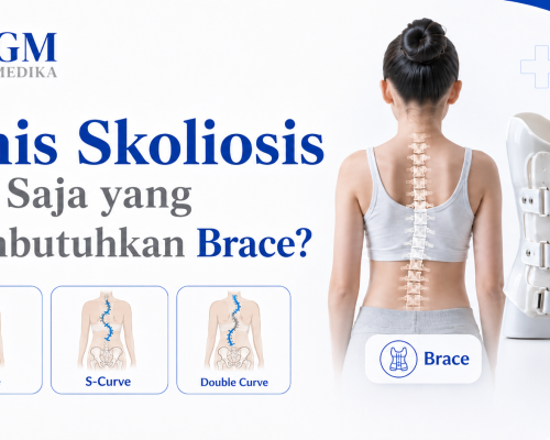 Jenis Skoliosis Apa Saja yang Membutuhkan Brace?
