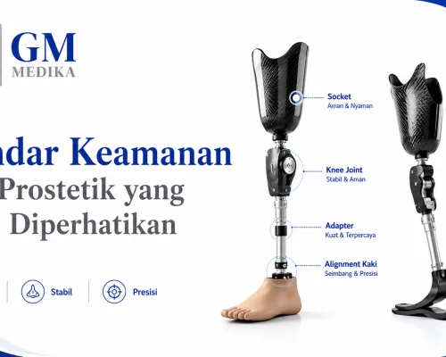 Standar Keamanan Alat Prostetik yang Perlu Diperhatikan