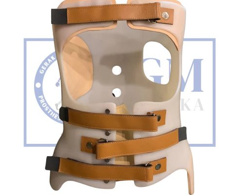Jual scoliosis brace indonesia